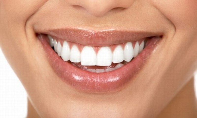 Как отбеливать зубы и не нанести им вреда?