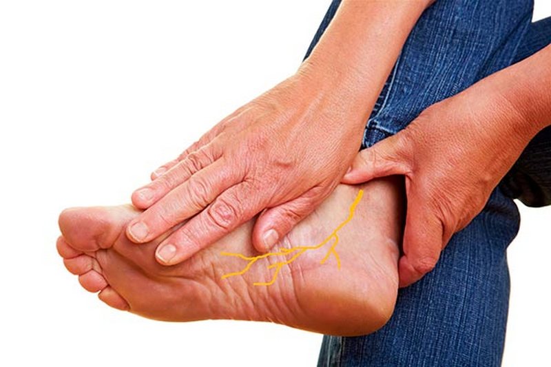 Как снять боль в ногах — простой план