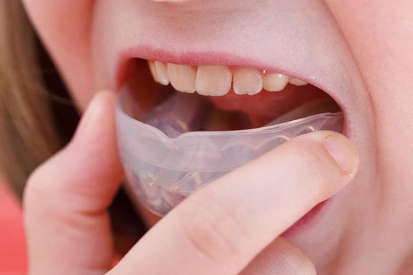 Исправление прикуса у детей пластинами: на популярные вопросы отвечает детский ортодонт Стоматологии «Улыбнись»