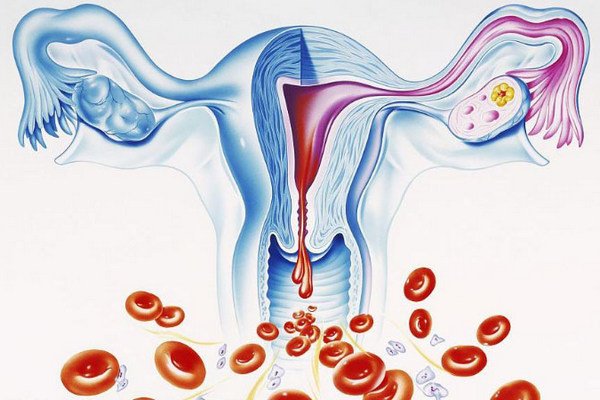 Настойка при дисфункциональных маточных кровотечениях, фибромиоме матки с геморрагическим синдромом