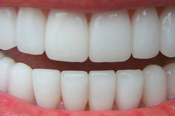 Установка коронок на передний зуб: какие виды коронок используются и п