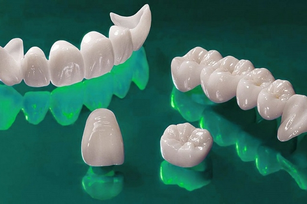 Установка коронок на передний зуб: какие виды коронок используются и почему они лучше виниров?
