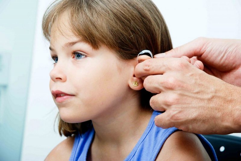 Эффективность бинаурального слухопротезирования у детей