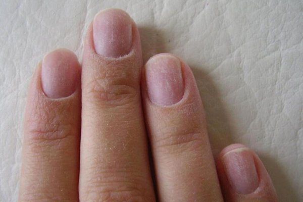Как восстановить ногти после гель-лака в домашних условиях
