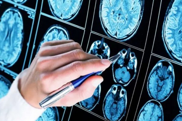 Ученые перечислили способы предотвращения старения мозга
