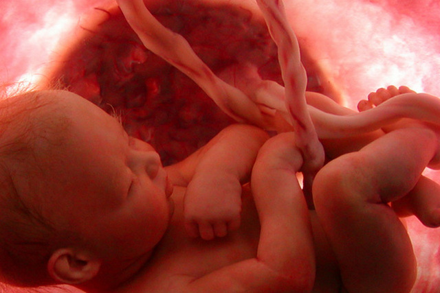 Среда в утробе матери может влиять на развитие мозга ребенка