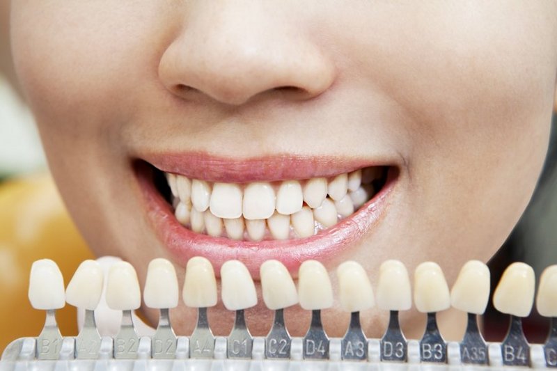Особенности пломбирования передних зубов современными светоотверждаемыми материалами