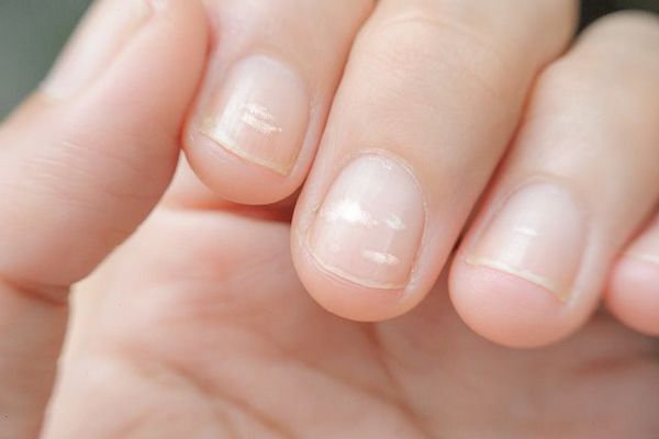 Как воск и желатин помогут при слоящихся ногтях?